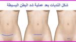 شد البطن بعد الولادة القيصرية