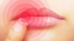 ما أسباب تشقق الشفاه