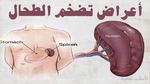ما هي أمراض الطحال