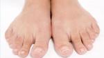 ما أسباب برودة القدمين
