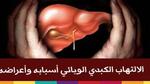 ما هو مرض الوباء الكبدي