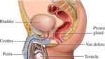 ما هو سبب احتقان البروستاتا