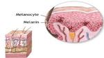 ما هي صبغة الميلانين