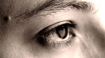 العين المحتقنة