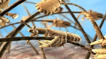 علاج سريع للقمل