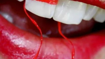 طريقة سريعة لتبيض الاسنان