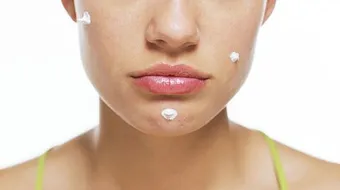 وصفة لإزالة الحبوب وآثارها بنتائج مضمونة ورائعة