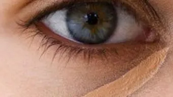 حل لمشكلة السواد تحت العين