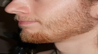 طريقة لنمو شعر الذقن بسرعة