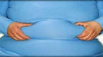 شفط الدهون من البطن