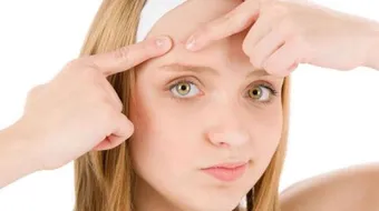 الوقاية من حب الشباب