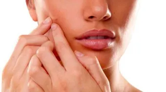 وصفات حب الشباب