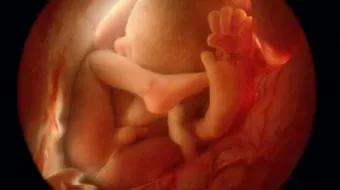 تعديل وضع الجنين من مقعدي إلى رأسي