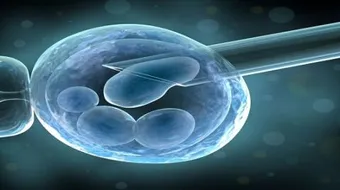 ما بعد ارجاع الاجنه