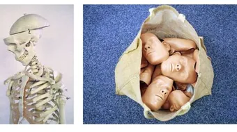 طرق انتقال مرض الإيدز