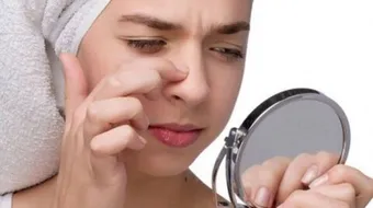 طريقة فعالة لإزالة الرؤوس السوداء على الأنف