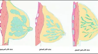 هل توجد غدد في الثدي