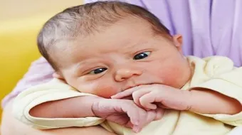 حول العين عند الرضع