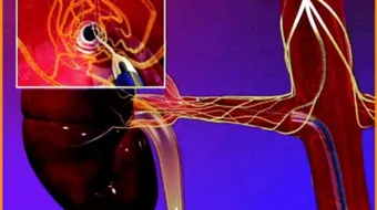 تنظيم الضغط الشرياني