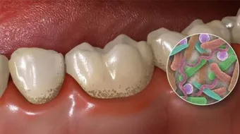 فوائد البكتيريا وأضرارها