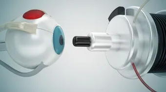 فوائد وأضرار عملية الليزر للعيون