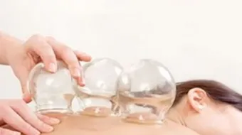 فوائد كاسات الهواء للحامل