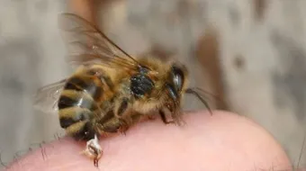 فوائد لسعة النحلة