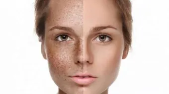 فوائد الكمون للبشرة