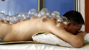 فوائد حجامة الظهر