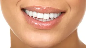 فوائد زيت الزيتون للأسنان