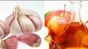 فوائد الخل والثوم للشعر