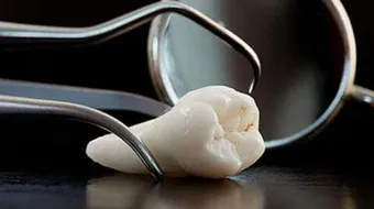 فوائد ضرس العقل