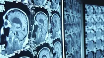 ما بعد اشعة الصبغة