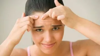 طرق إزالة الرؤوس السوداء