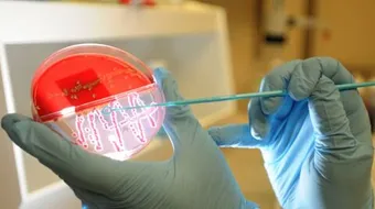 تحليل مزرعة الدم