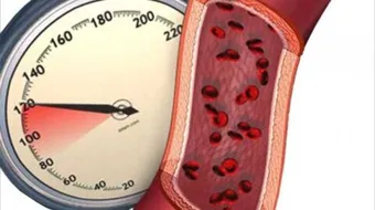 ضغط الدم و أسبابه