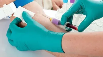 فحص قوة الدم