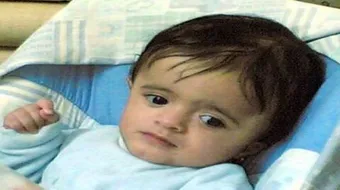 ضمور المخ عند الأطفال وعلاجه