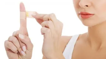 آثار الحروق وعلاجها