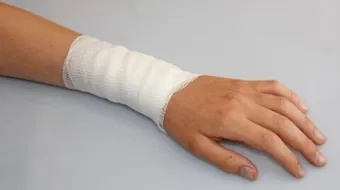 طرق علاج الحروق