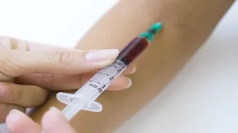 تحليل فيروس سي