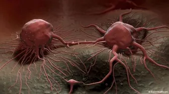 طرق علاج السرطان