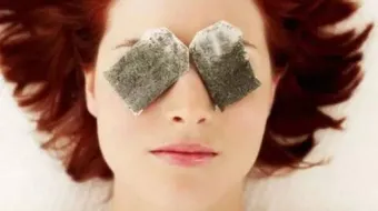 أسباب الهالات السوداء وعلاجها