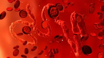 أسباب فقر الدم وكيفية تشخيصه