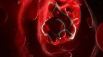 أسباب تخثر الدم