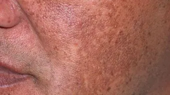 أسباب تصبغات الجسم