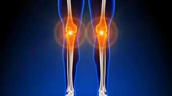 أسباب آلام العظام