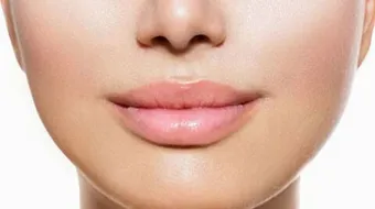 أسباب سواد الشفاه