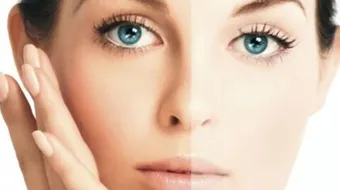 أسباب اسمرار البشرة