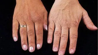 أسباب تغير لون الجلد